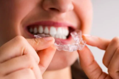 Clear Aligner Orthodontics